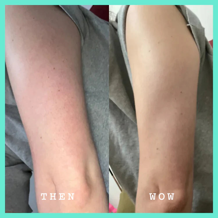Vorher-Nachher-Vergleich der FRANK BODY Smoothing AHA Body Lotion zeigt eine deutlich glattere Haut am Arm
