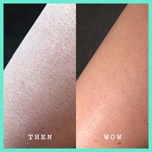 Vorher-Nachher-Effekt der FRANK BODY Smoothing AHA Body Lotion zeigt den Wandel von trockener zu glatter, gepflegter Haut