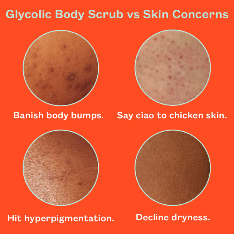 Grafik zum FRANK BODY Glycolic Body Scrub zeigt Lösungen für Reibeisenhaut, Pigmentflecken, Pickel und trockene Haut