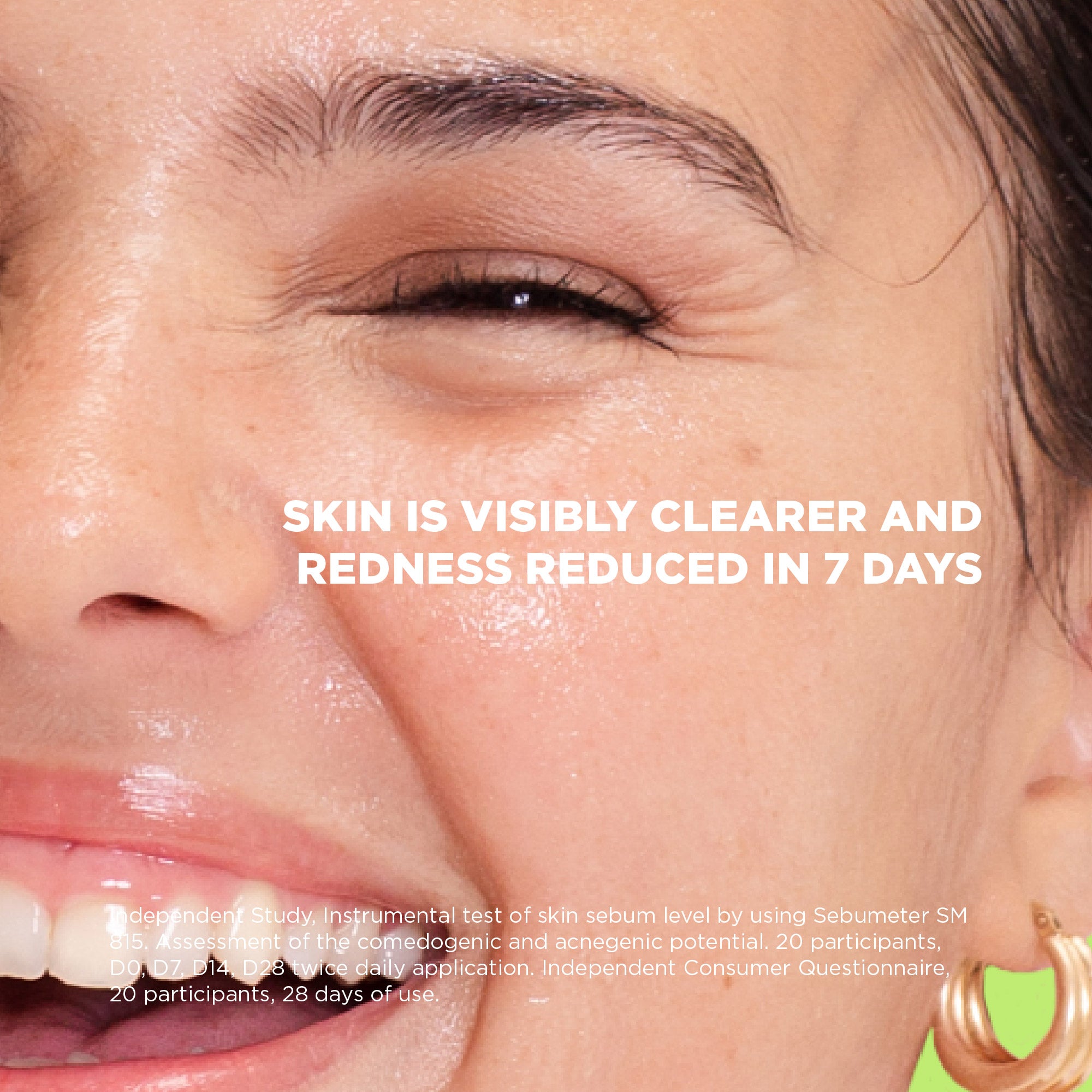 SKIN REPUBLIC Salicylsäure 2% Serum Detail – 30ml Pipettenflasche