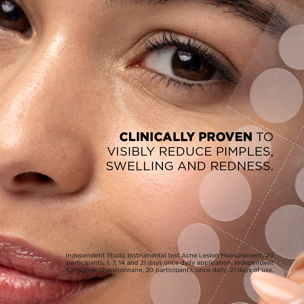 SKIN REPUBLIC Spot Clear Patches – 48 patchs anti-boutons à l'acide salicylique